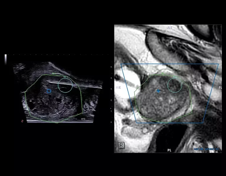 csm_clinical-images-10_61c755cb4d
