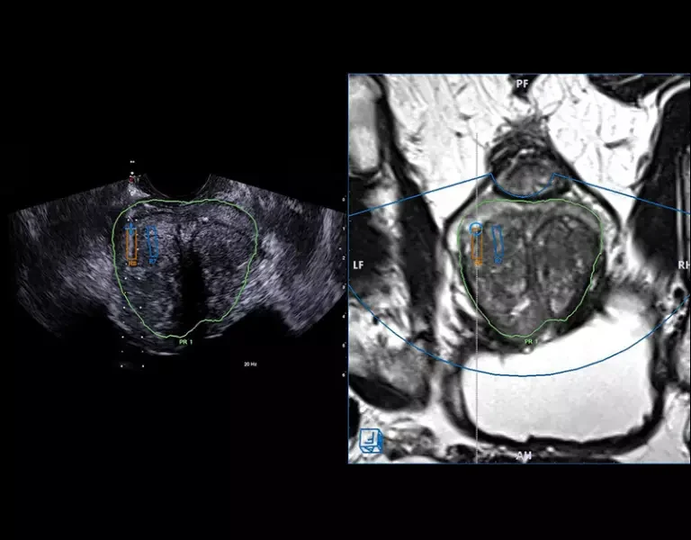 csm_clinical-images-11_f1048bc017