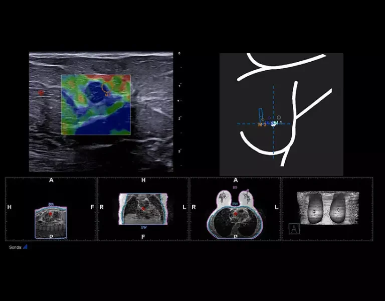 csm_clinical-images-12_e73d46d885