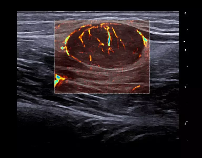 csm_clinical-images-13_4876f62cdc