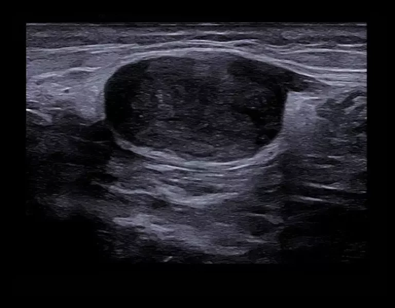 csm_clinical-images-14_2838f14f3a