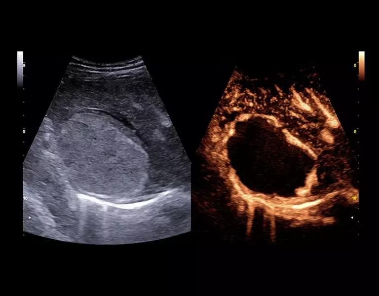csm_clinical-images-17_f943556d7a