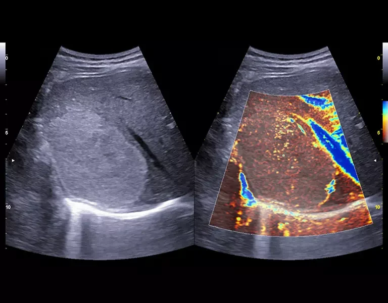 csm_clinical-images-18_d3e2879834