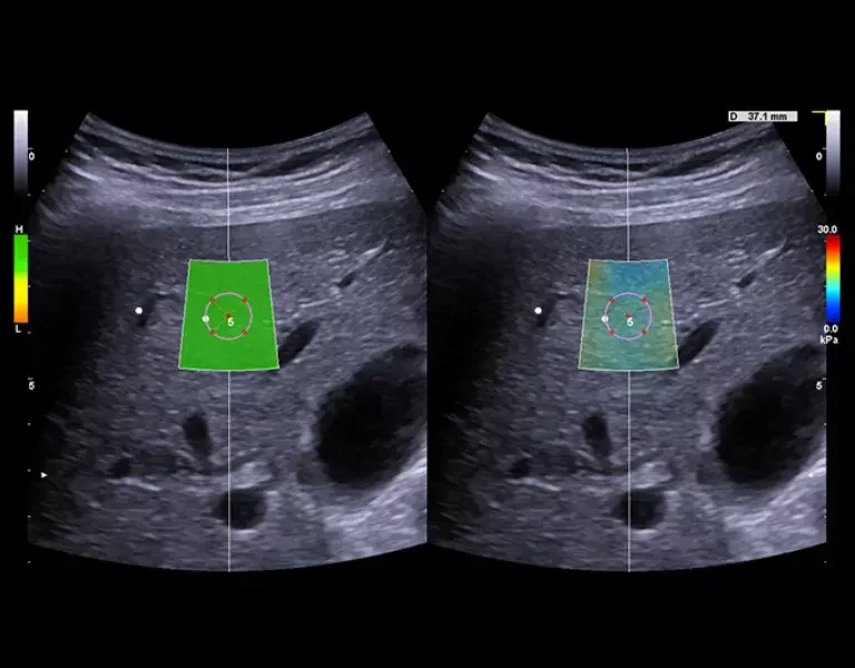 csm_clinical-images-19_31c40b7230