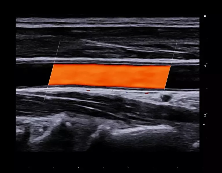 csm_clinical-images-1_d672634a90