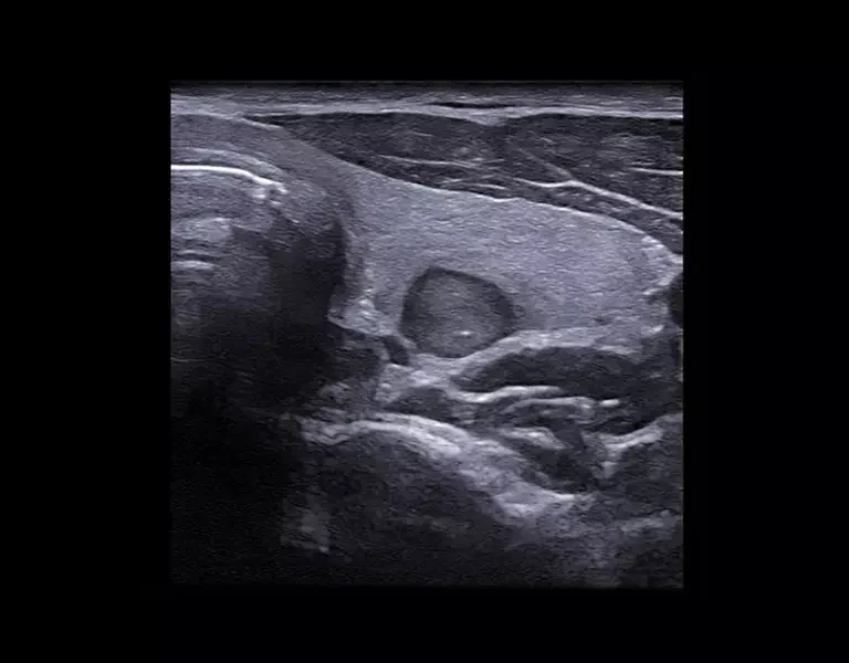 csm_clinical-images-20_6f820bd399