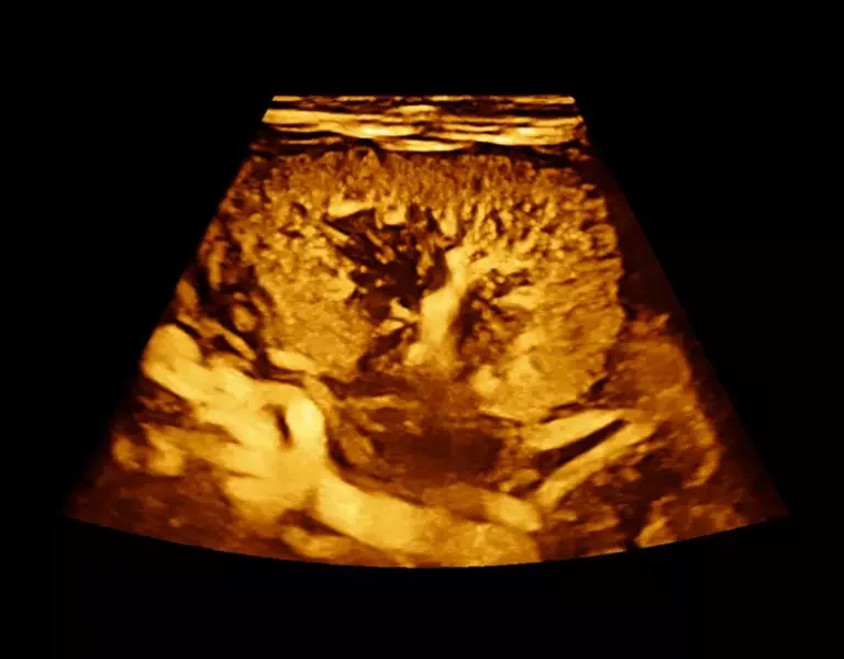 csm_clinical-images-24_d2b30a2f5f
