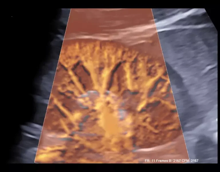 csm_clinical-images-26a_86cbbcfd95