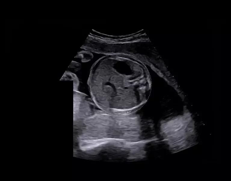 csm_clinical-images-27_bfb2e82f05