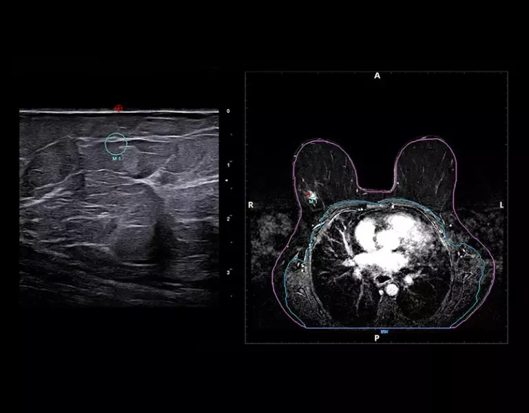 csm_clinical-images-29_d7af6c11b7
