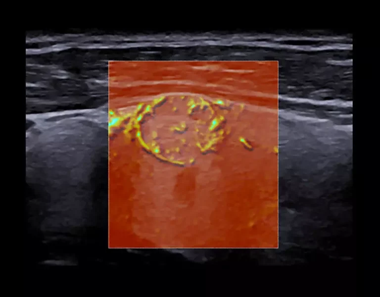 csm_clinical-images-2_866bdde766