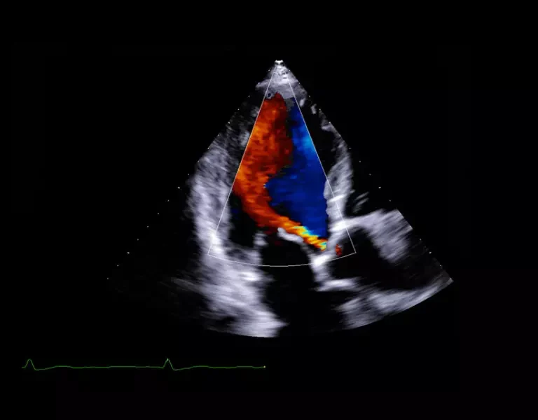 csm_clinical-images-31_c1ca8a3fe1