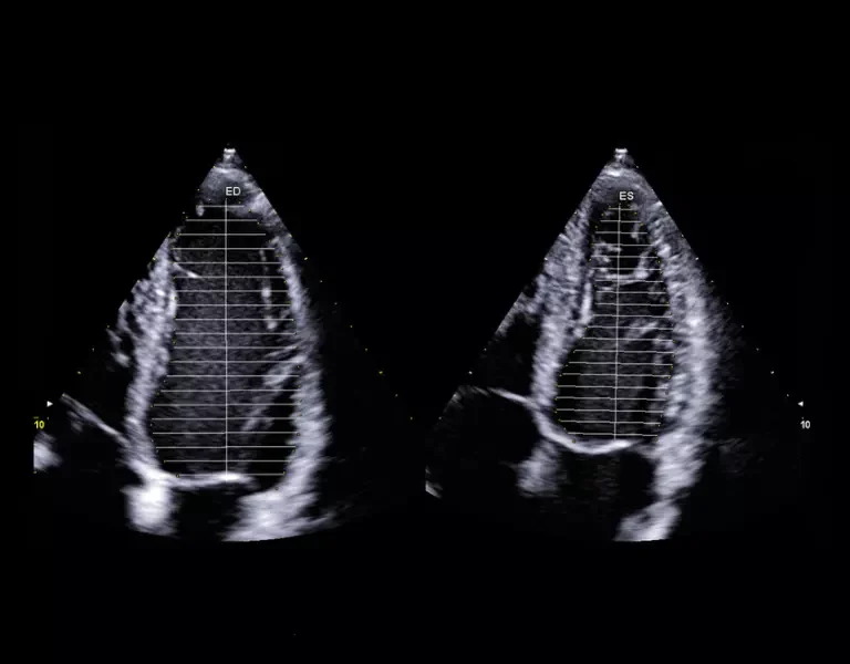 csm_clinical-images-32_c04fa5c2fb