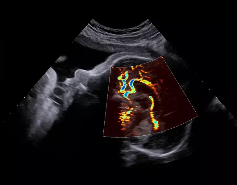csm_clinical-images-33_257f8fea16