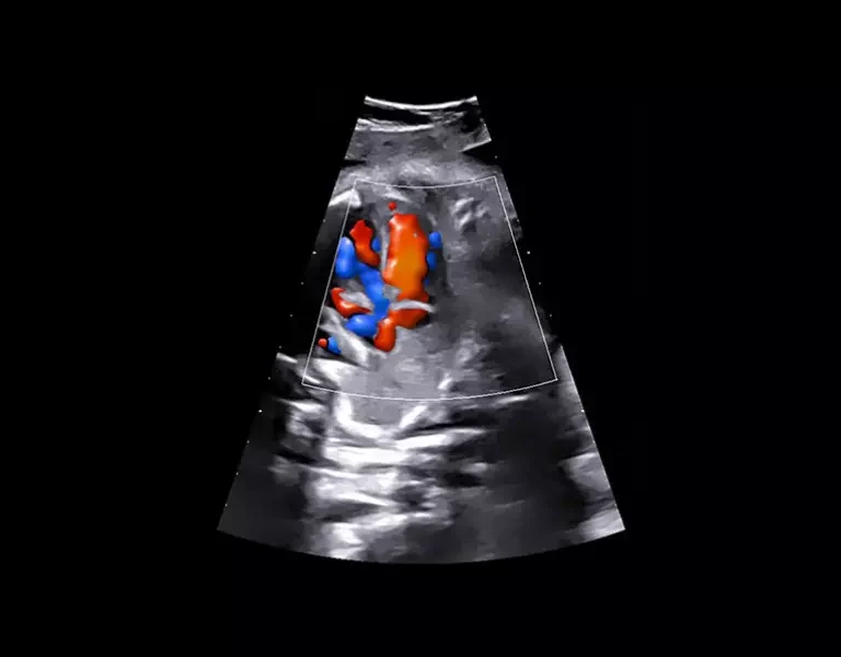 csm_clinical-images-34_2b5f1d19ad