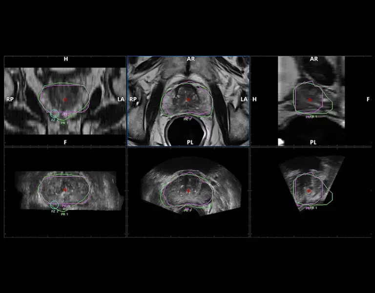 csm_clinical-images-35_cb1be74846