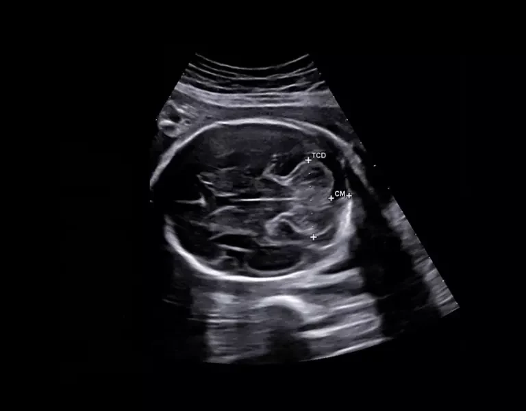 csm_clinical-images-39_ef452c492b