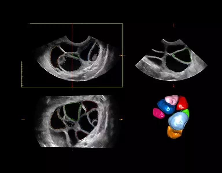 csm_clinical-images-3_459a3d2329