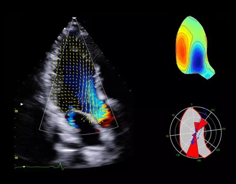 csm_clinical-images-4_0ff090b513