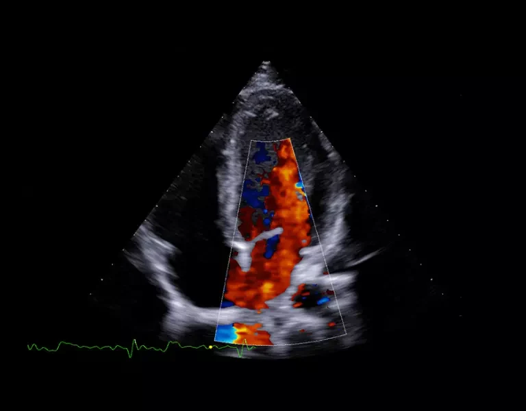 csm_clinical-images-6_63aade09b7