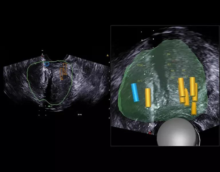 csm_clinical-images-8_2f2caa1d55