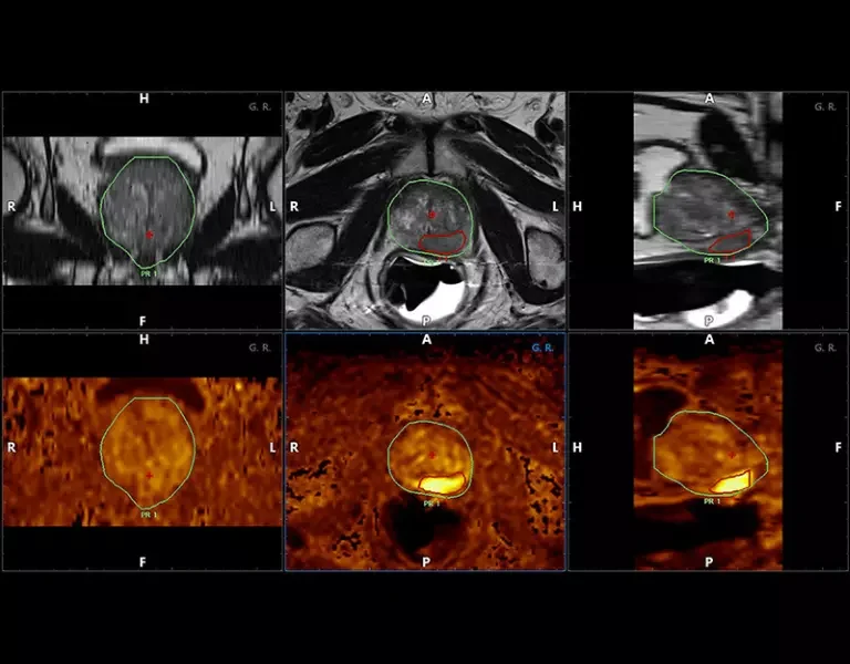 csm_clinical-images-9_e8705f4f9d
