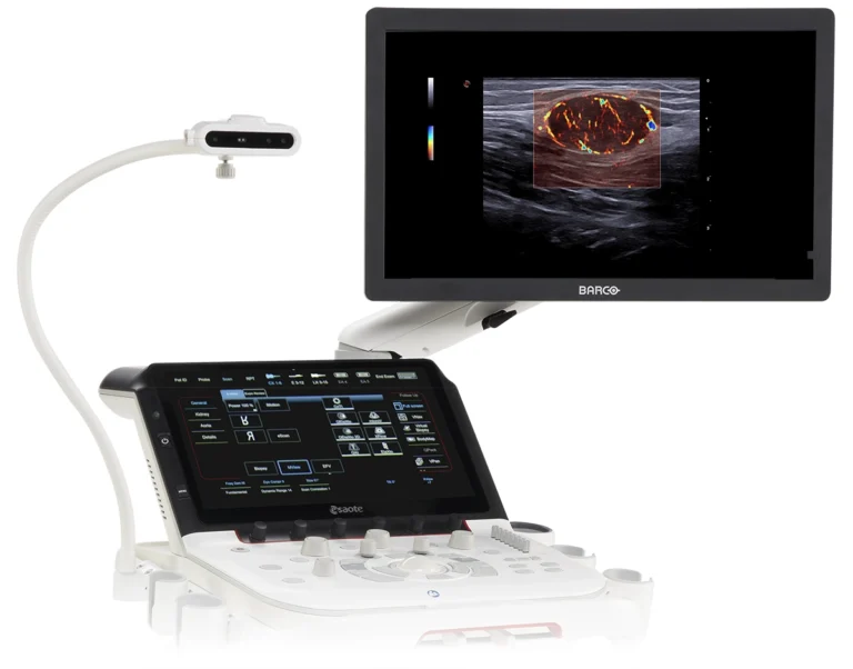 ultrasonograf (usg) esatore mylab x90