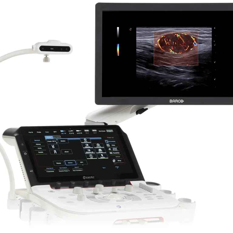 ultrasonograf (usg) esatore mylab x90