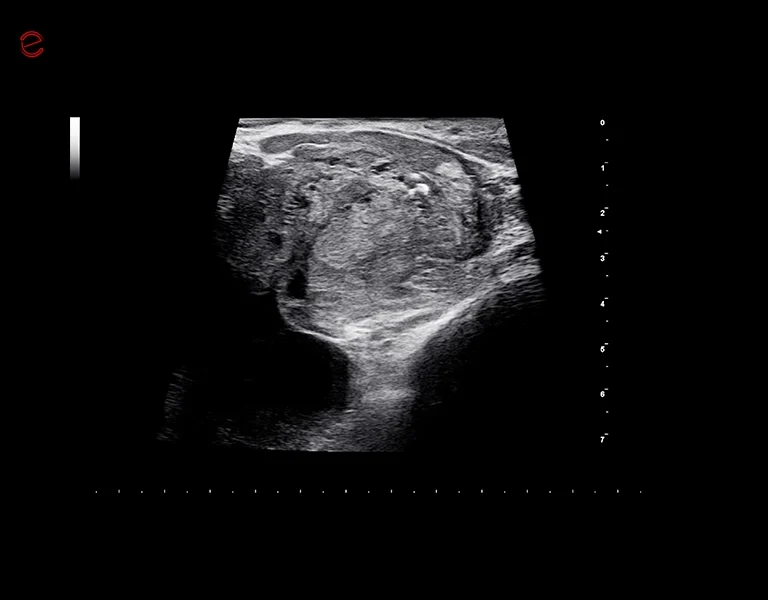 obraz z ultrasonografu esaote mylab c25 TP-IQ