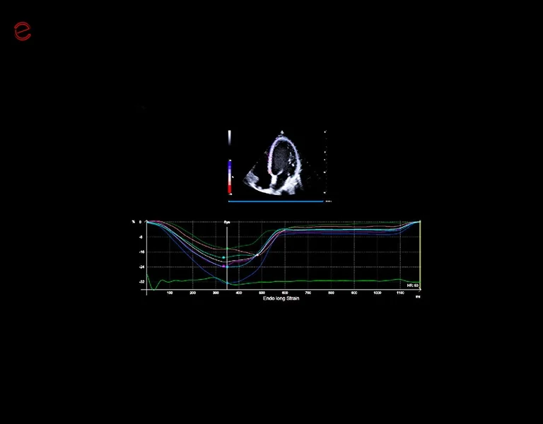 obraz z usg esaote mylab c25 xstrain