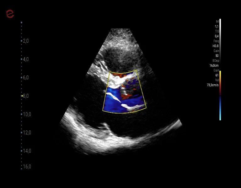 Q7 - CV Cardio