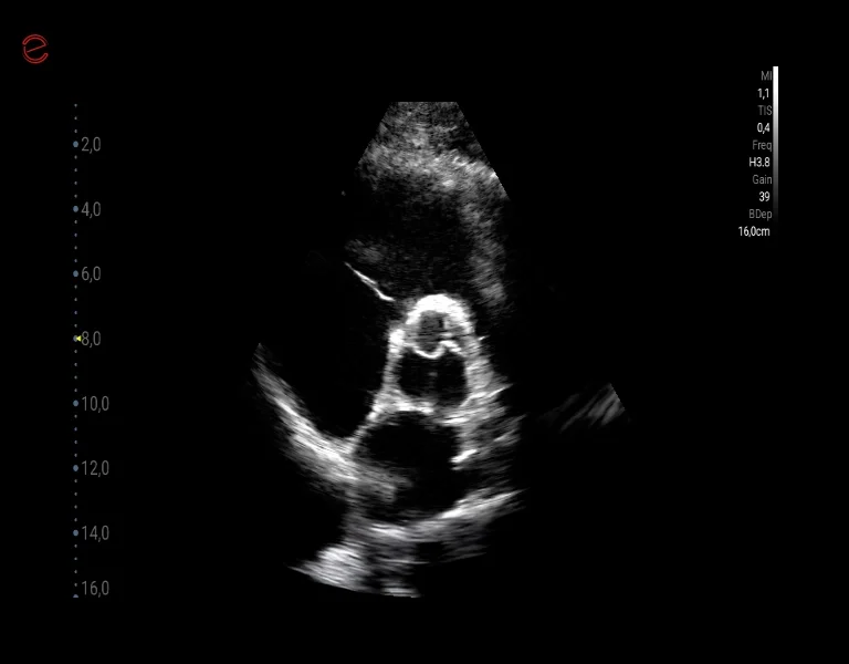 Q7 - CV Cardio B Mode 2