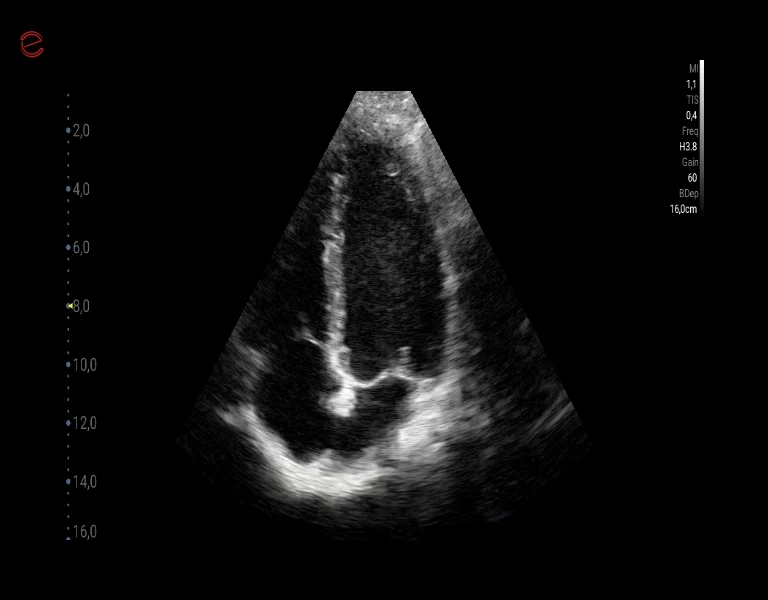 CV Cardio B-mode