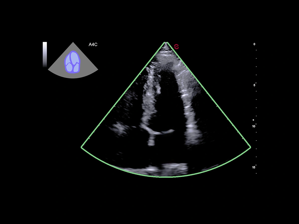 obrazowanie z wykorzystaniem technologi heartscan