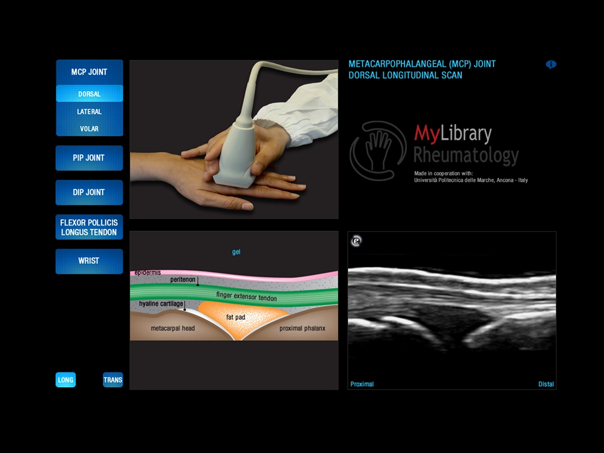korzystanie z Esaote MyLibrary Rheumatology